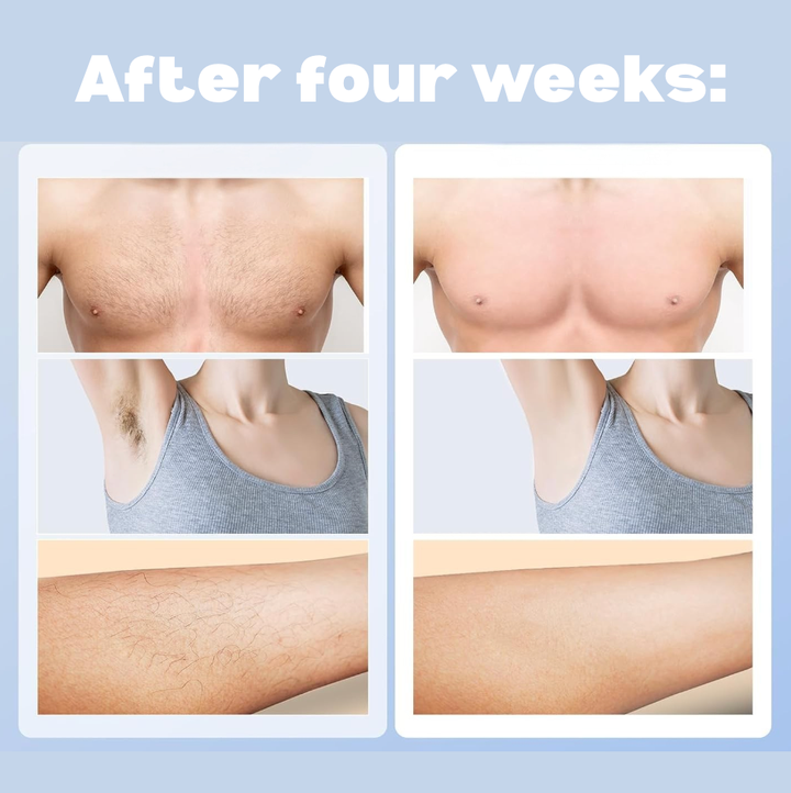 This hair removal tools gives you spa-like treatment at home.