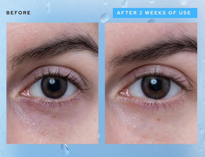 The gel works fast.