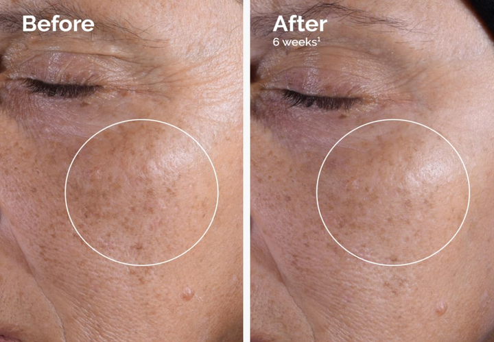 This toner is designed to reduce age spots with consistent application.